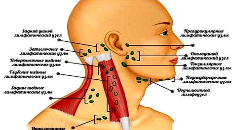 На фото схема расположения шейных лимфатических узлов