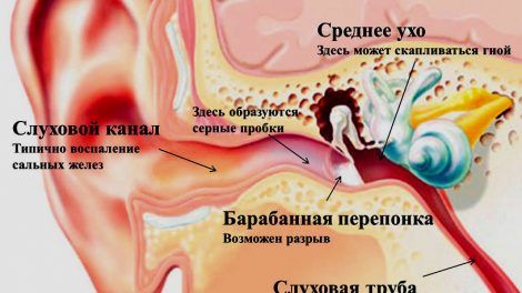 Сильно болит ухо внутри с одной стороны, отдает: чем лечить в домашних условиях ухо и горло